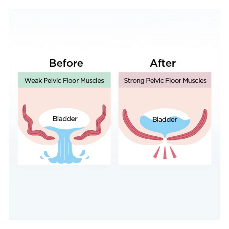 Mytrex Aqua Qutto Entrenador de Suelo Pélvico con EMS