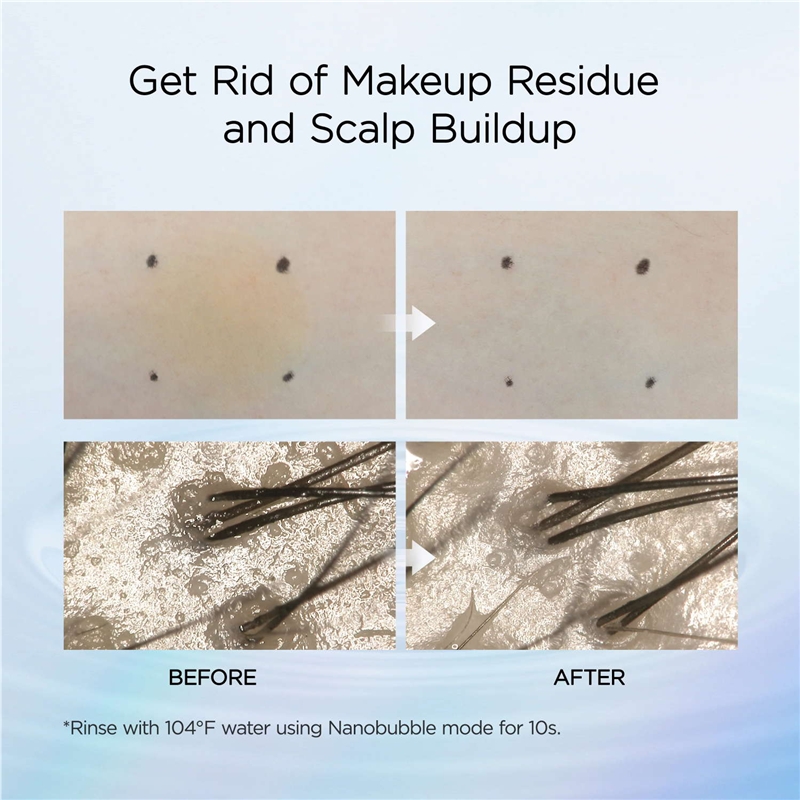 Mytrex HiHo Fine Bubble +e Cabezal de ducha SPA con burbujas y microcorriente