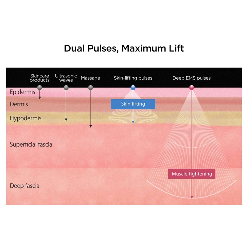 Mytrex Prove EMS Dispositivo de Belleza 3-en-1 Reafirmante y Lifting (Para Cuero Cabelludo/Cara/Cuerpo)