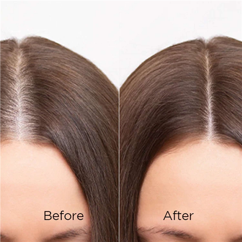 Mytrex Prove EMS Dispositivo de Belleza 3-en-1 Reafirmante y Lifting (Para Cuero Cabelludo/Cara/Cuerpo)