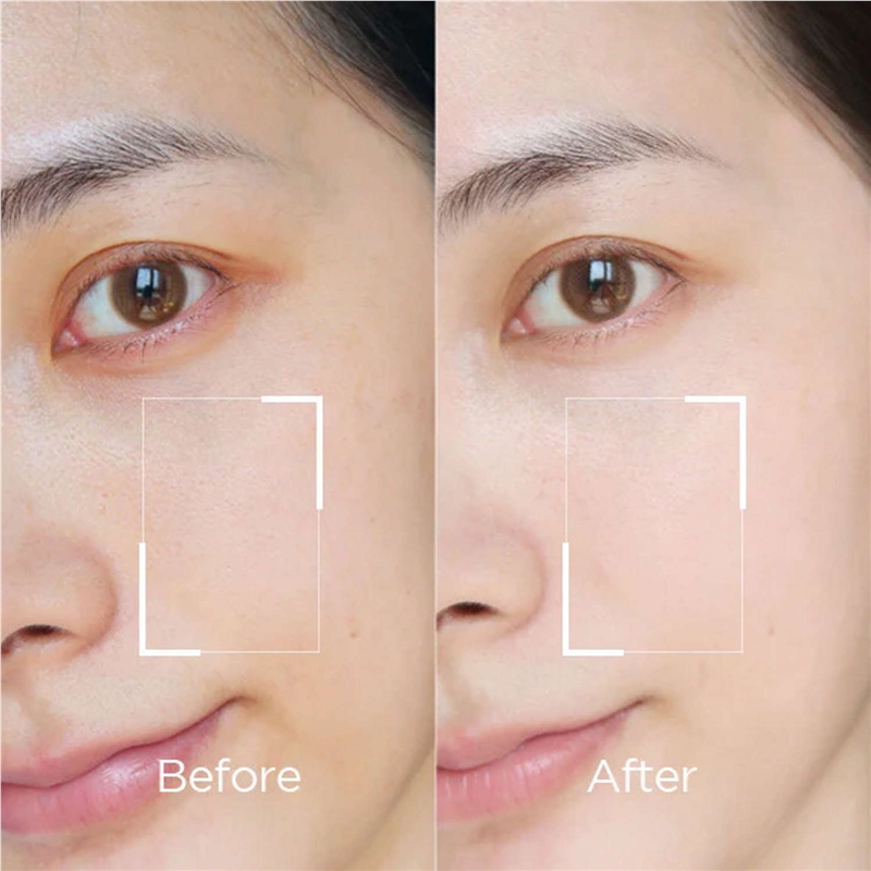 Mytrex Prove EMS Dispositivo de Belleza 3-en-1 Reafirmante y Lifting (Para Cuero Cabelludo/Cara/Cuerpo)