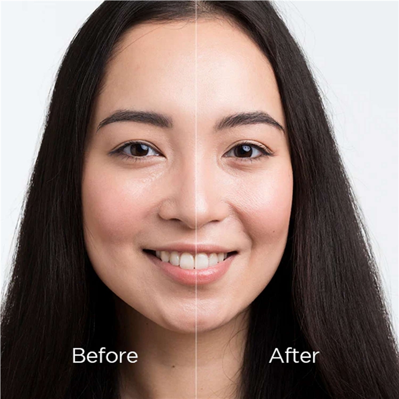 Mytrex Prove EMS Dispositivo de Belleza 3-en-1 Reafirmante y Lifting (Para Cuero Cabelludo/Cara/Cuerpo)